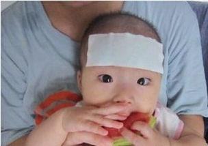 小孩吃苹果瓜发烧,警惕水果安全与儿童健康